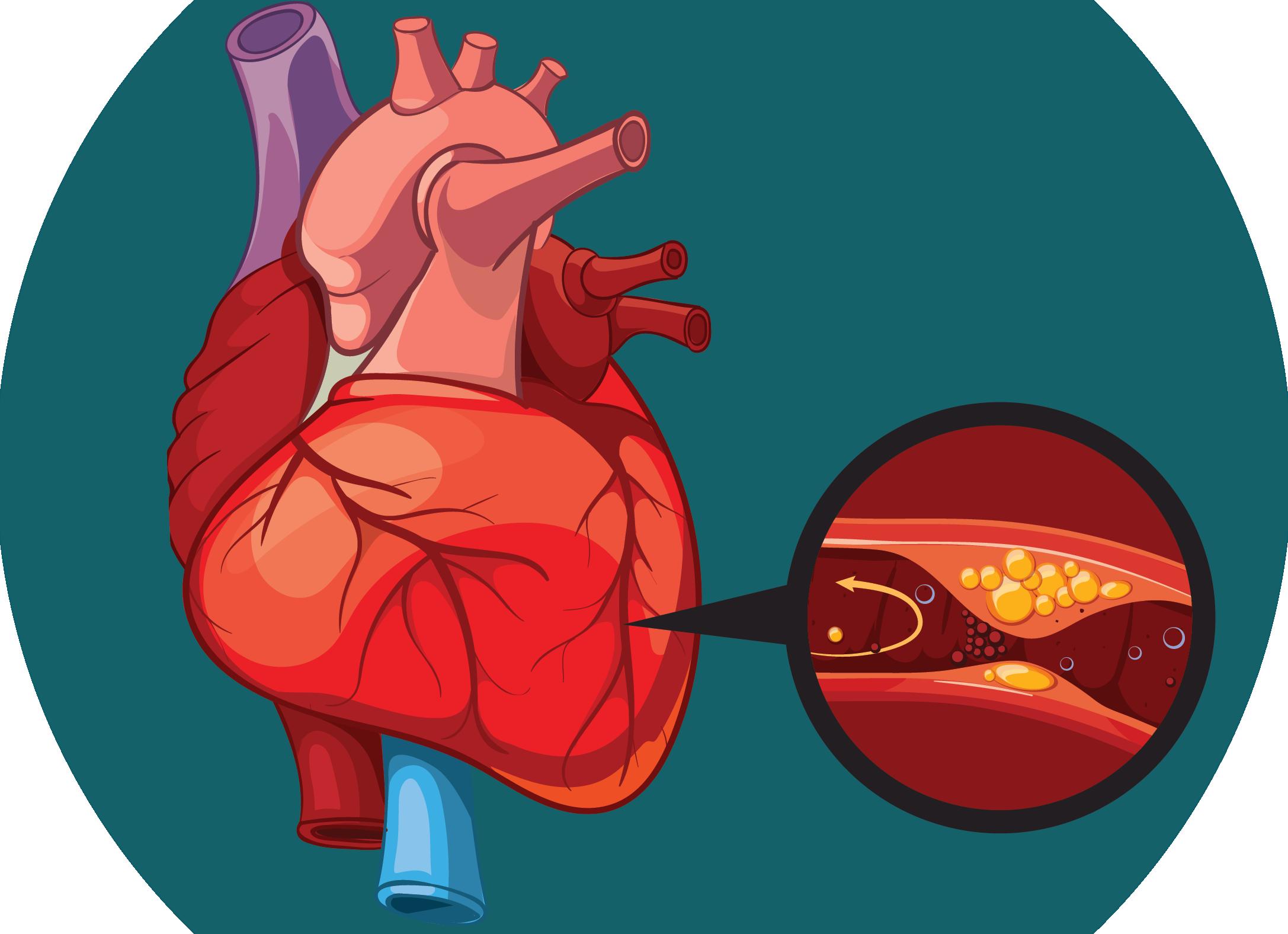 Пенсия по инвалидности после инсульта - 2021 год Пенсия по инвалидности после инсульта - 2021 год